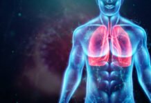 El incremento del virus sincicial impacta de forma directa en los casos de bronquiolitis y neumonía